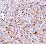 Anti-Nms Antibody Boster Bio