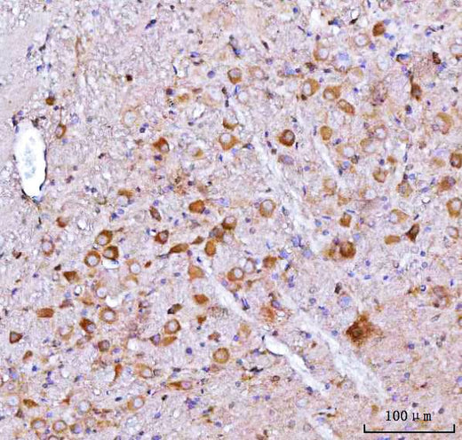 Anti-Nms Antibody Boster Bio