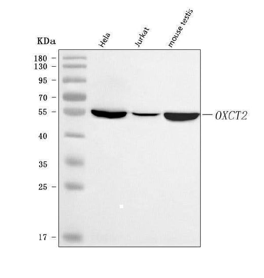 Anti-OXCT2 Antibody Picoband® Boster Bio