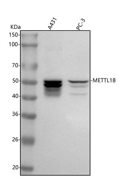 Anti-METTL18 Antibody Picoband® Boster Bio