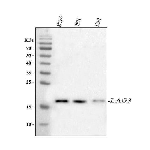 Anti-LAGE3 Antibody Picoband® Boster Bio
