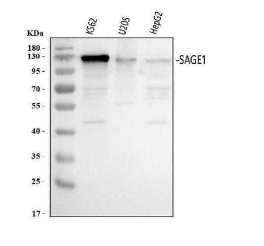 Anti-SAGE1 Antibody Picoband® Boster Bio