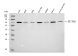 Anti-KBTBD2 Antibody Picoband® Boster Bio