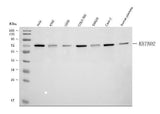 Anti-KBTBD2 Antibody Picoband® Boster Bio