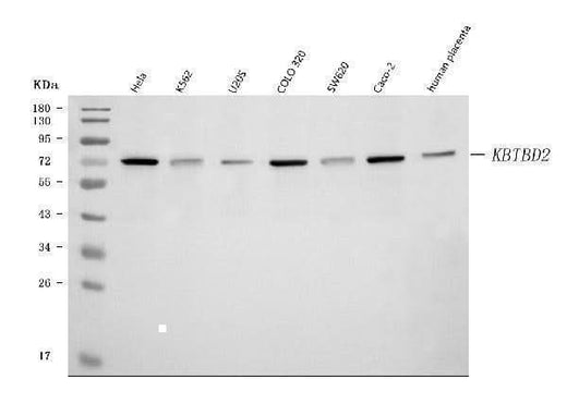 Anti-KBTBD2 Antibody Picoband® Boster Bio