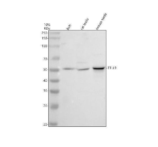 Anti-TTLL9 Antibody Picoband® Boster Bio