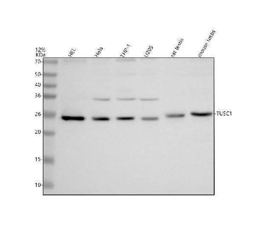 Anti-TUSC1 Antibody Picoband® Boster Bio