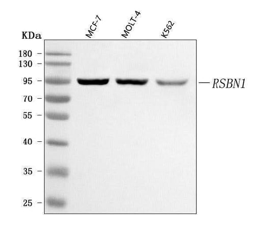 Anti-RSBN1 Antibody Picoband® Boster Bio