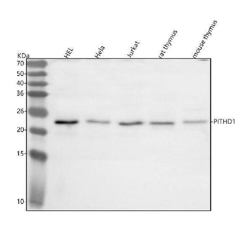 Anti-PITHD1 Antibody Picoband® Boster Bio