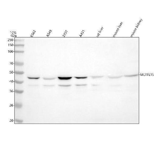 Anti-METT5D1/METTL15 Antibody Picoband® Boster Bio