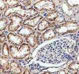 Anti-SLC16A13 Antibody Boster Bio
