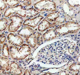 Anti-SLC16A13 Antibody Boster Bio