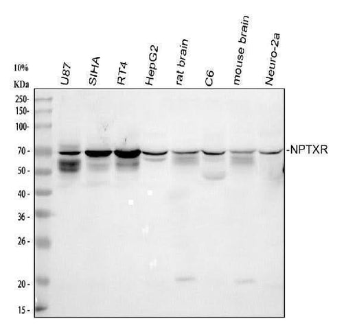 Anti-NPTXR Antibody Picoband® Boster Bio
