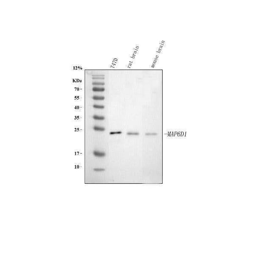 Anti-MAP6D1 Antibody Picoband® Boster Bio