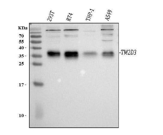 Anti-TM2D3 Antibody Picoband® Boster Bio