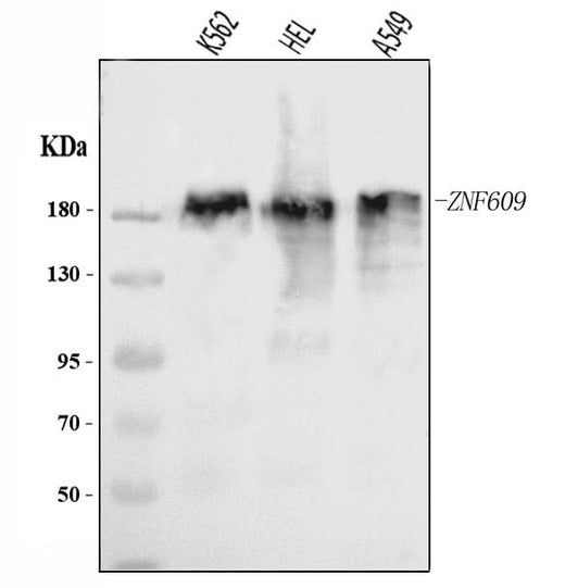 Anti-ZNF609 Antibody Picoband® Boster Bio