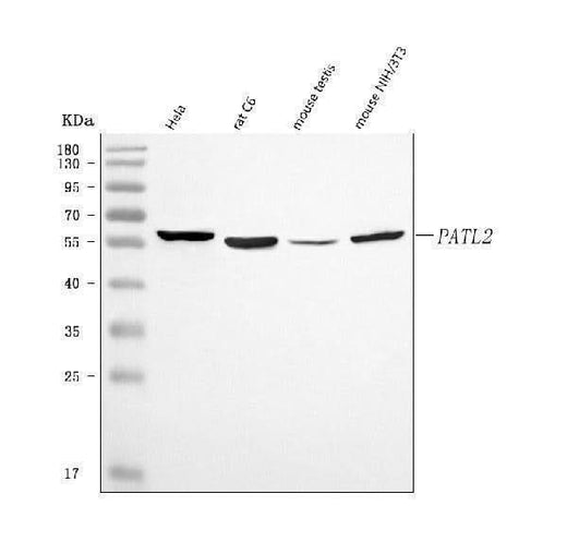 Anti-PATL2 Antibody Picoband® Boster Bio