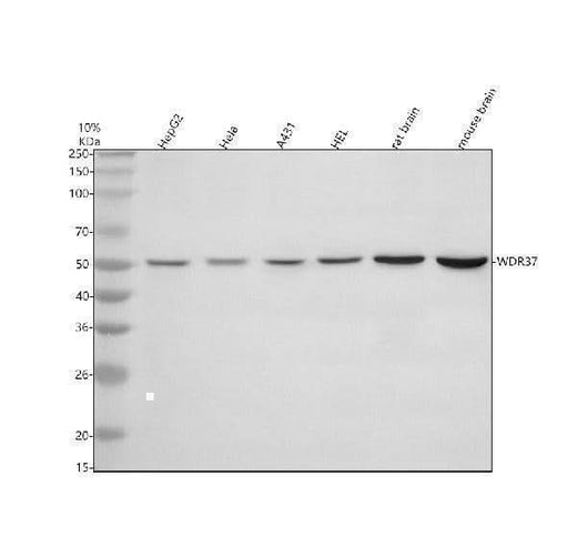 Anti-WDR37 Antibody Picoband® Boster Bio