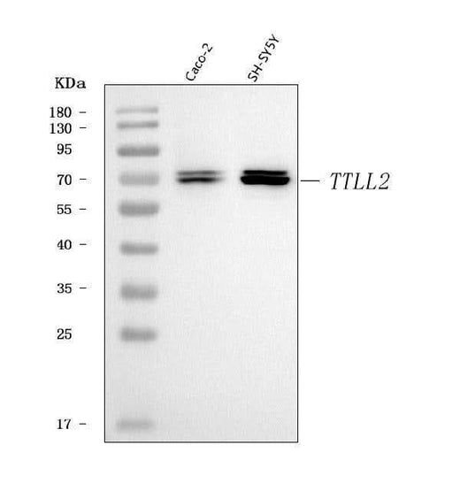 Anti-TTLL2 Antibody Picoband® Boster Bio