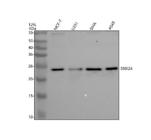 Anti-SNX24 Antibody Picoband® Boster Bio