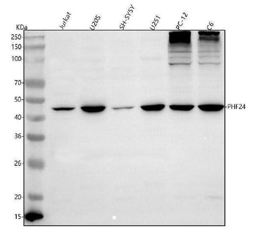 Anti-PHF24 Antibody Picoband® Boster Bio