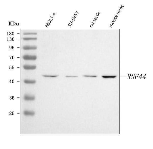 Anti-RNF44 Antibody Picoband® Boster Bio