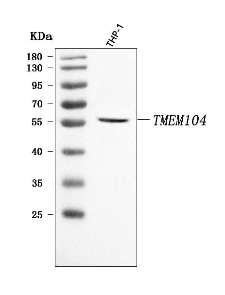 Anti-TMEM104 Antibody Picoband® Boster Bio