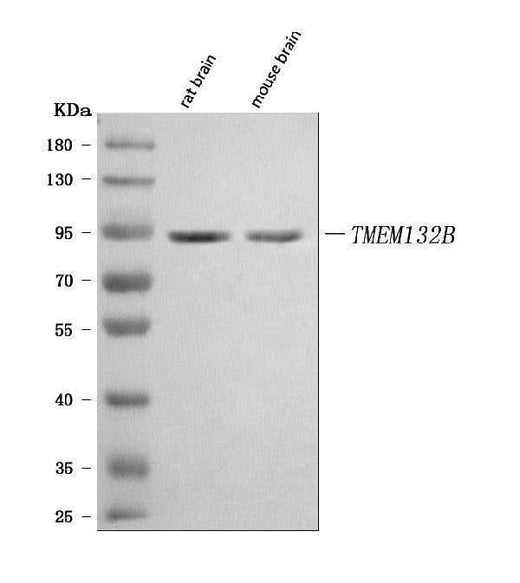 Anti-TMEM132B Antibody Picoband® Boster Bio