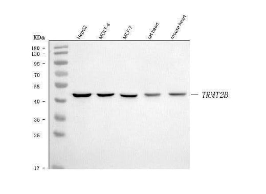Anti-TRMT2B Antibody Picoband® Boster Bio