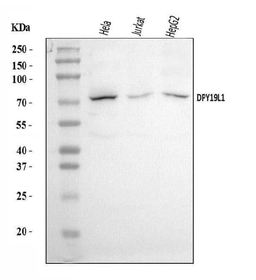 Anti-DPY19L1 Antibody Picoband® Boster Bio