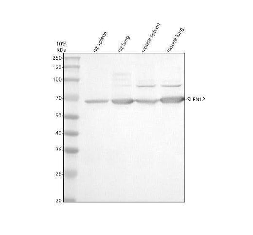 Anti-SLFN12 Antibody Picoband® Boster Bio