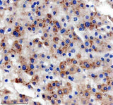 Anti-SLC22A25 Antibody Boster Bio