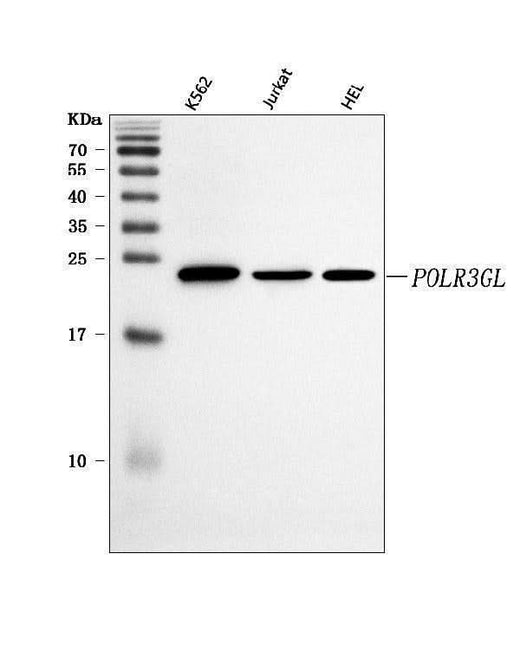 Anti-POLR3GL Antibody Picoband® Boster Bio