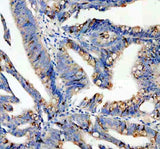 Anti-SPINK4 Antibody Boster Bio