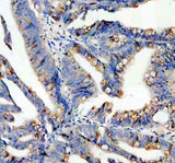 Anti-SPINK4 Antibody Boster Bio