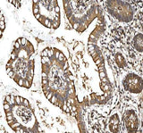 Anti-SMIM8 Antibody Boster Bio