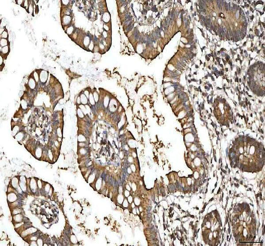 Anti-SMIM8 Antibody Boster Bio