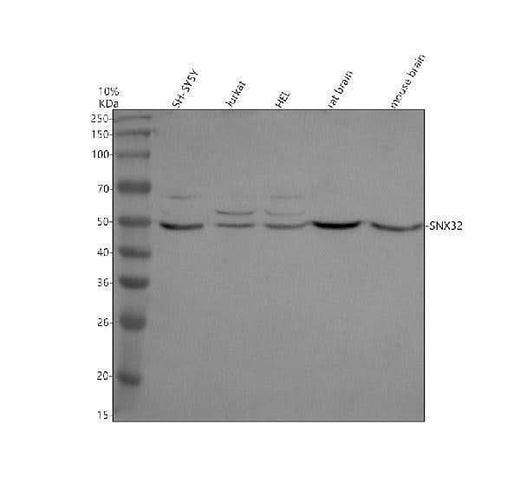 Anti-SNX32 Antibody Picoband® Boster Bio