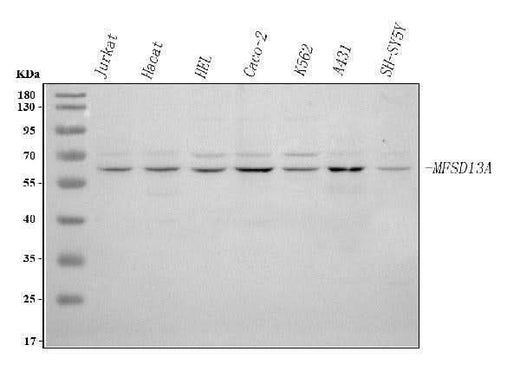 Anti-MFSD13A Antibody Picoband® Boster Bio