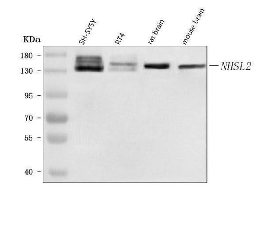 Anti-NHSL2 Antibody Picoband® Boster Bio