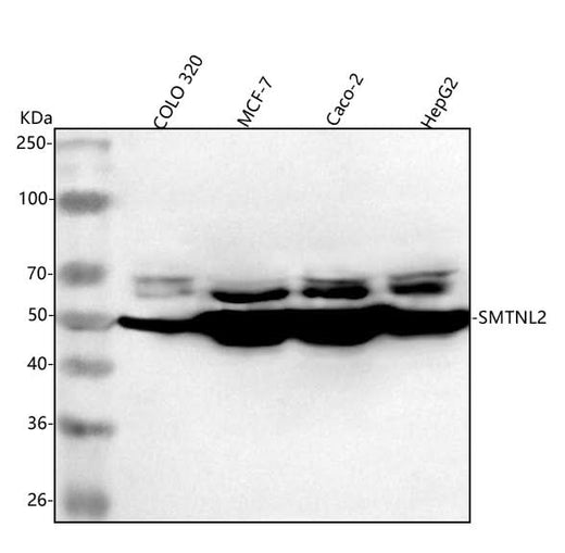 Anti-SMTNL2 Antibody Picoband® Boster Bio