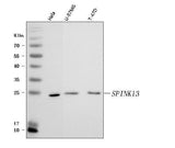 Anti-SPINK13 Antibody Picoband® Boster Bio