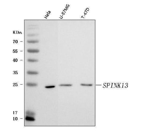 Anti-SPINK13 Antibody Picoband® Boster Bio