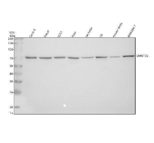 Anti-LMNTD2 Antibody Picoband® Boster Bio