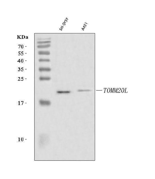 Anti-TOMM20L Antibody Picoband® Boster Bio