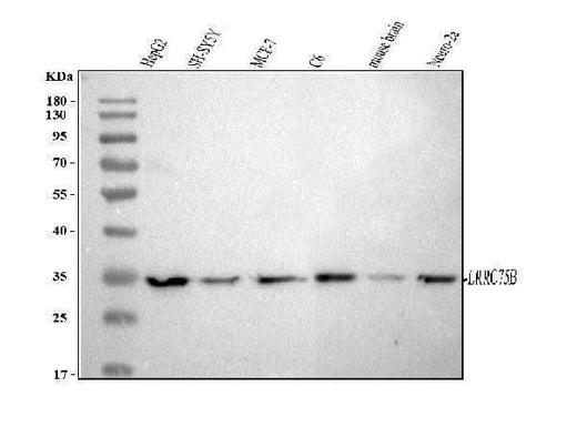 Anti-LRRC75B Antibody Picoband® Boster Bio