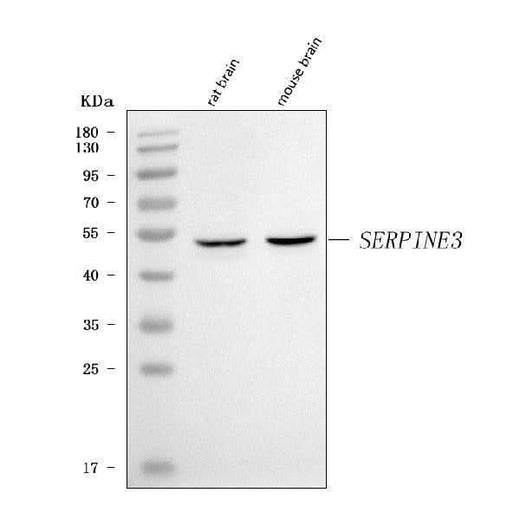 Anti-SERPINE3 Antibody Picoband® Boster Bio