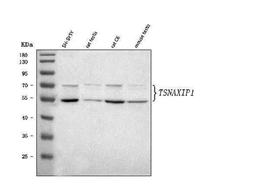 Anti-TSNAXIP1 Antibody Picoband® Boster Bio