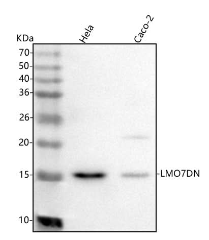 Anti-LMO7DN Antibody Picoband® Boster Bio