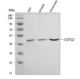 Anti-STPG2 Antibody Picoband® Boster Bio